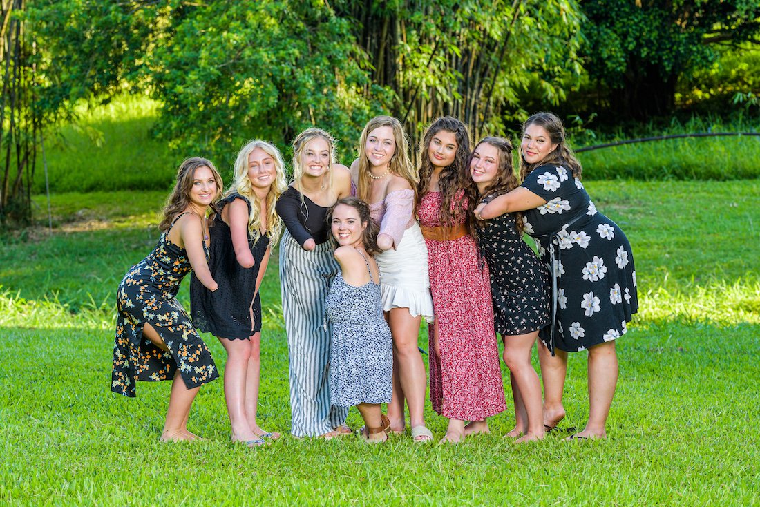 A group photo of Beautifully Flawed girls smiling while proudly showing off their arm limb differences, some from amputations and others from birth.